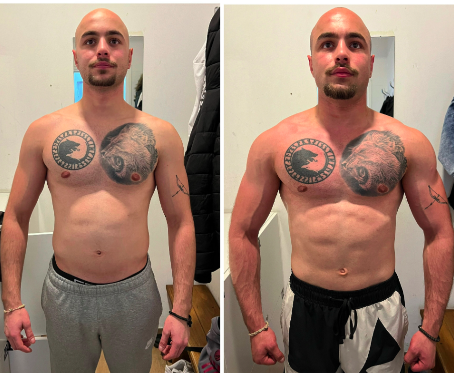 💥 Novi rezultat u timu 💥 Slika lijevo 74kg. Slika desno 79kg. - Napredak drugara,klijenta za 30 dana saradnje. Dobili smo 5kg. U ovih 30 dana pored kilaže što nam je skočila biceps nam je s početnog stanja 37cm skočio na 40.5cm. Obim struka spao za 2.5cm, dok nam je noga skočila za 1.5cm. - Momak je dugo u trenažnom procesu i morali smo prvih par treninga da odradimo korekciju na vježbe zatim smo dodali gas sa radnim težinama. - Što se tiče ishrane radili smo rotaciju UH, gdje smo držali proteine na 200g, mast na 60g a UH-(300-250-200). Bravo bruda moj, nastavljamo dalje još jače i ide brutalan “update” za par mjeseci. 🦾🦾